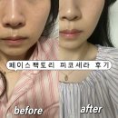 부스터즈 | [관리에 진심인사람] 페이스팩토리 피코세라 부스터즈 갈바닉 뷰티디바이스 내돈내산 후기💕