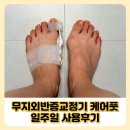 주식회사 엄지 | 무지외반증교정기 케어풋 일주일 사용 솔직후기
