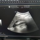88플러스내과의원 네이버블로그