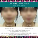 상반 | 대전동구피부과 울쎄라 후기가 상반되는 이유 ‘이것’ 때문입니다