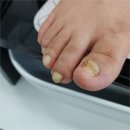 에이네일 이미지