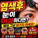 송탄성모안과의원 네이버블로그