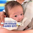 부산대학교 | 100일 아기 유피낭종 수술해야 할까? 양산부산대학교병원 진료후기
