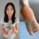 올리브영풋크림 메디필EGF스케일링모이스처풋크림보들발크림 후기