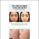 P-5F04 | [디자인블럭] he04 : Before &amp; After 후기 – 눈으로 확인되는 실사용 변화를 강조하는 후기 블럭