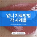 에이플란트치과의원 이미지