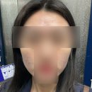 글로우마켓 | 톰더글로우 베이직 당근마켓 중고 후기｜민감성 피부 홈케어 디바이스 1단계 사용 후기
