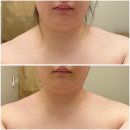 몸펴기 | 위뷰티 다녀온 솔직 후기 어깨결림풀기랑 굽은등펴기 받고 힐링 완료!