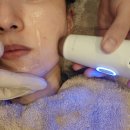 개 쿨 | 쿨소닉 맛집 비본영의원 안아픈 초음파리프팅 후기