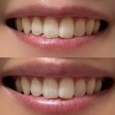 나우 | 페리오 화이트나우 내돈내산 후기