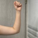 씨유안양운동장점 | 안양 범계 다이어트 팔뚝관리 고주파 + 지방분해주사 솔직후기