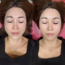 글로미의원 이미지