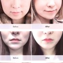 리프업의원 이미지