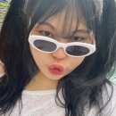 [쌍꺼풀수술후기] 눈두덩이 지방제거+매몰쌍수 1년 후 솔직 후기 | 마크성형외과