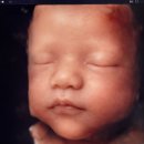 더미즈병원 | 성남 더미즈병원 입체초음파 28주차 후기