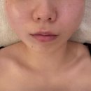 조코라인 | 부산 범내골 윤곽관리 루체떼에스테틱 - 작은 얼굴관리