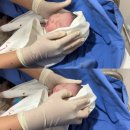 연세마디탑의원 | 39주 5일 초산모 제왕절개 후기 | 연세하임 산부인과