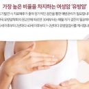 유방암 검사 피 한방울로 끝 이미지