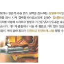 명성레이져 이미지