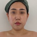 피부숨소리