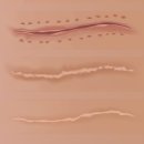 제노스템 이미지