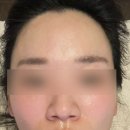 여리한 다이어트(압구정점) | 여리한다이어트 압구정점 :: 내돈내산 슬림80 후기