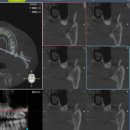 연세이로운치과의원 이미지