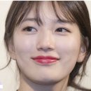 나도 했다 쌍수 1~8일차 [순간유착 후기]