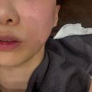 더 페이즈 | 센텀피부과 부산신부관리 고주파 레이저 리프팅 쿨페이즈 600샷 찐후기