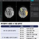 (주)제이엘케이 이미지