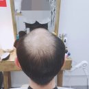 동수의가발이야기 | 인천가발 고민중이라면 스탐모 지니위그 추천합니다!