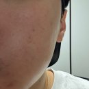 (주)데이셀코스메틱 | [데이셀 코스메틱] 고은 딜 발효 크림 마스크 – 탄력과 보습을 동시에!