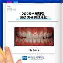 365플러스일산선명점 | 일산추천치과, 2025 스케일링 더 늦기전에 지금 받으세요!