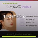 예스성형외과의원 네이버블로그