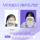 (주)대유코아 부산지점 | 항암치료후2번째 부산수제맞춤가발후기/시원한여름가발