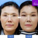 비씨아이성형외과의원 이미지