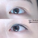 아이앤드유