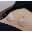 까치한의원 이미지