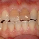 스토리치과의원 이미지