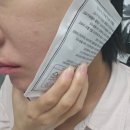 미소가(이수점) | 이수역 치과에서 받은 치아미백 후기, 하루 만에 환해진 미소