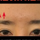 노블와이성형외과의원 이미지