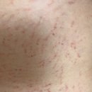 스킨52부천지부 이미지