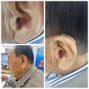 전주벨톤보청기 | “인공지능이 소리를 바꾼다?” 스타키 제네시스 AI 실사용 후기