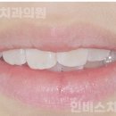 인비스치과의원 이미지