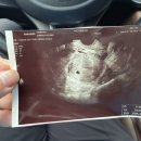 목포한사랑병원 이미지