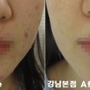 리유한의원 네이버블로그