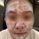 바로그의원 | [피부과후기] 봉명동 바로그의원 유성점｜내돈내산 점빼기+프락셀 시술 후기🧖‍♀️💥 (사진O)