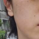 순수안피부과의원 이미지