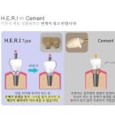 이든치과기공소 이미지