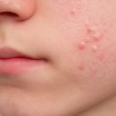 박재민한의원 이미지